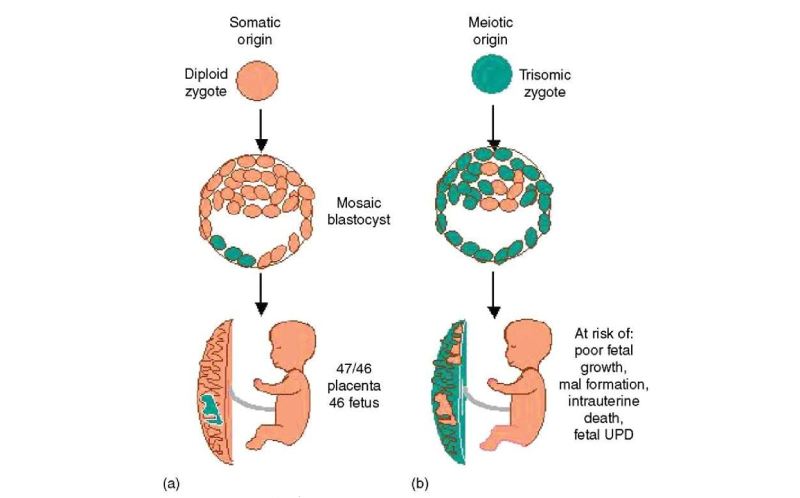 Exploring the Mosaic of Birth Defects